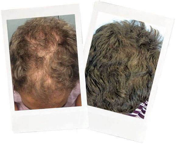  Name: Allen* <br>Age: 26 </br>Occupation: Actor