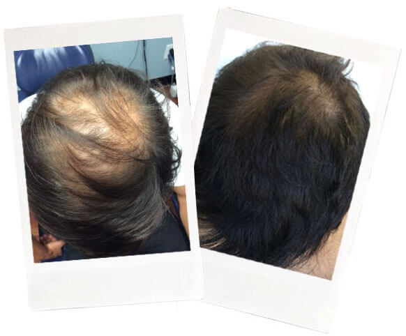  Name: Justin* <br>Age: 23 <br>Occupation: Film Editor