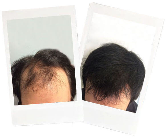  Name: Luke* <br>Age: 41 <br>Occupation: Bartender