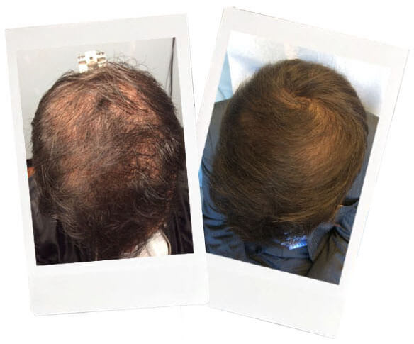  Name: Phillip* <br>Age: 34 <br>Occupation: Real Estate Broker